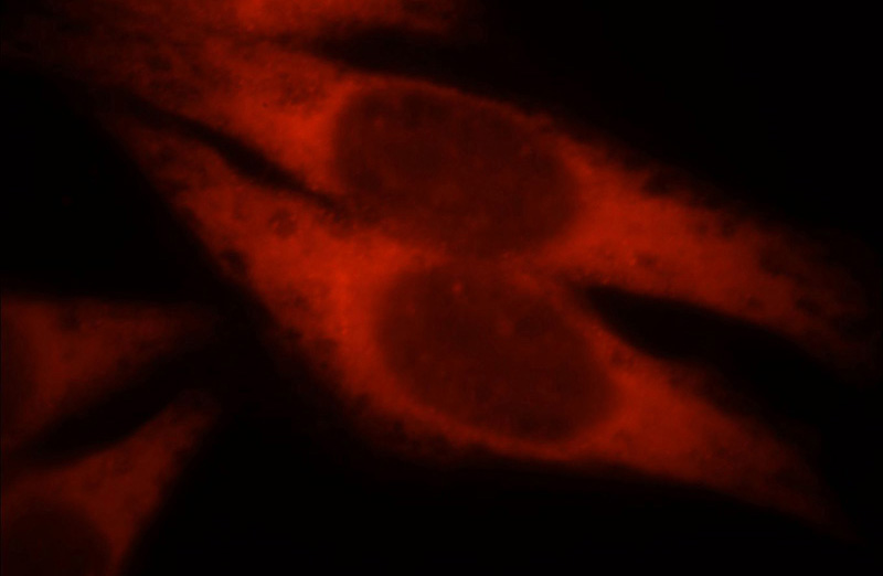 Immunofluorescent analysis of Hela cells, using KLHL35 antibody Catalog No:112106 at 1:25 dilution and Rhodamine-labeled goat anti-rabbit IgG (red).