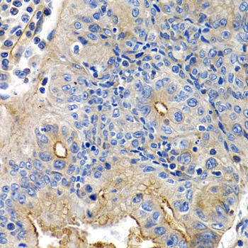 Immunohistochemistry - PTGIR Polyclonal Antibody 