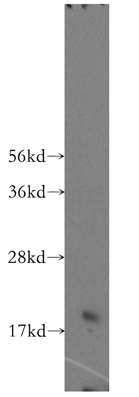 mouse liver tissue were subjected to SDS PAGE followed by western blot with Catalog No:112851(MRPS24 antibody) at dilution of 1:500