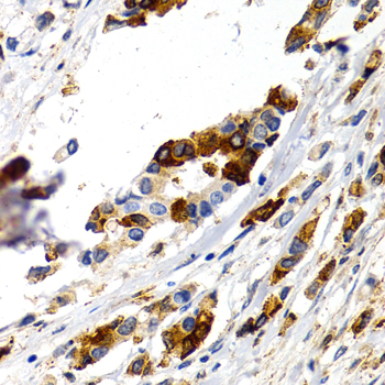 Immunohistochemistry - TFF1 Polyclonal Antibody 