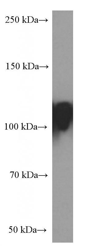 HUVEC cells were subjected to SDS PAGE followed by western blot with Catalog No:107370(LAMP2 Antibody) at dilution of 1:1000