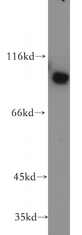 Jurkat cells were subjected to SDS PAGE followed by western blot with Catalog No:109034(ENTPD1 antibody) at dilution of 1:500