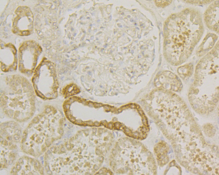 Fig5: Immunohistochemical analysis of paraffin-embedded human kidney tissue using anti-Osteoprotegerin antibody. Counter stained with hematoxylin.