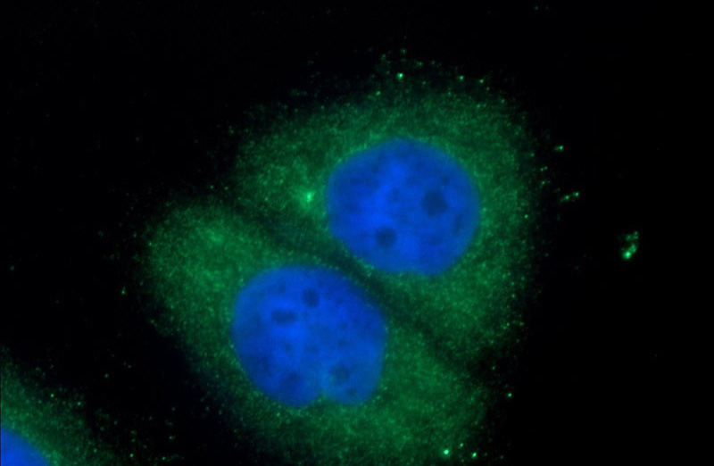 Immunofluorescent analysis of HeLa cells using Catalog No:114434(RAB35 Antibody) at dilution of 1:50 and Alexa Fluor 488-congugated AffiniPure Goat Anti-Rabbit IgG(H+L)