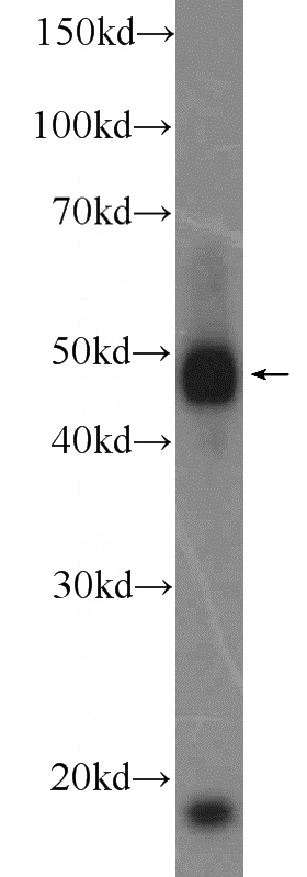 HepG2 cells were subjected to SDS PAGE followed by western blot with Catalog No:114756(RNF26 Antibody) at dilution of 1:300