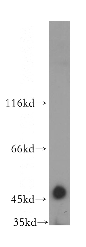 HepG2 cells were subjected to SDS PAGE followed by western blot with Catalog No:110542(FBXL14 antibody) at dilution of 1:800