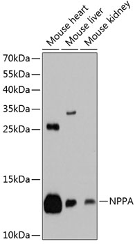Western blot - NPPA Polyclonal Antibody 