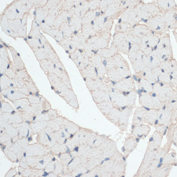 Immunohistochemistry - DMD Polyclonal Antibody 