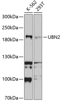 Western blot - UBN2 Polyclonal Antibody 