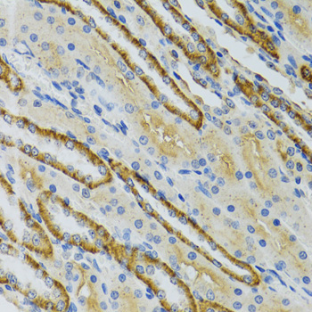 Immunohistochemistry - COG2 Polyclonal Antibody 