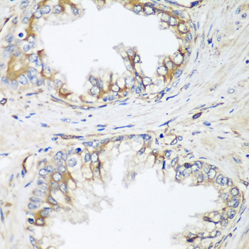 Immunohistochemistry - HPSE2 Polyclonal Antibody 