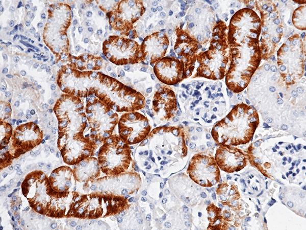 SLC3A2 / CD98 Antibody, Rabbit MAb, Immunohistochemistry
