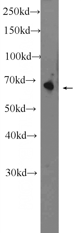 mouse heart tissue were subjected to SDS PAGE followed by western blot with Catalog No:113511(OTOP1 Antibody) at dilution of 1:300