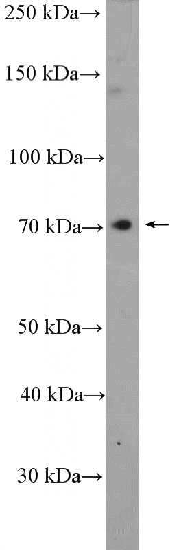 HepG2 cells were subjected to SDS PAGE followed by western blot with Catalog No:107703(ACSS3 Antibody) at dilution of 1:300