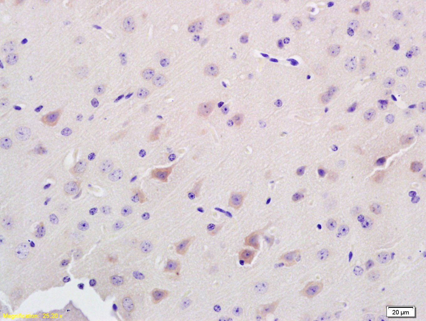 Fig1: Tissue/cell: rat brain tissue; 4% Paraformaldehyde-fixed and paraffin-embedded;; Antigen retrieval: citrate buffer ( 0.01M, pH 6.0 ), Boiling bathing for 15min; Block endogenous peroxidase by 3% Hydrogen peroxide for 30min; Blocking buffer (normal goat serum,C-0005) at 37℃ for 20 min;; Incubation: Anti-ADAMTS7 Polyclonal Antibody, Unconjugated 1:200, overnight at 4℃, followed by conjugation to the secondary antibody(SP-0023) and DAB(C-0010) staining