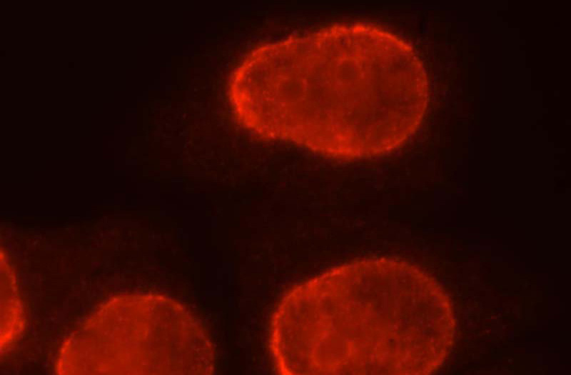 Immunofluorescent analysis of HepG2 cells, using BXDC2 antibody Catalog No:108558 at 1:25 dilution and Rhodamine-labeled goat anti-rabbit IgG (red).