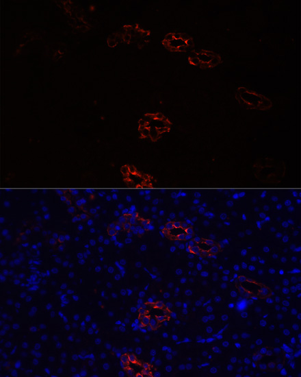 Immunofluorescence - AQP2 Polyclonal Antibody 