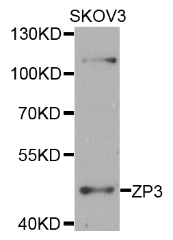 Western blot - ZP3 Polyclonal Antibody 