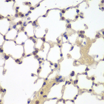 Immunohistochemistry - Estrogen Receptor beta Polyclonal Antibody 