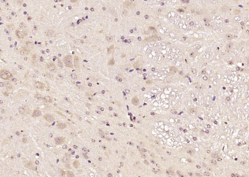Fig3: Paraformaldehyde-fixed, paraffin embedded (mouse brain); Antigen retrieval by boiling in sodium citrate buffer (pH6.0) for 15min; Block endogenous peroxidase by 3% hydrogen peroxide for 20 minutes; Blocking buffer (normal goat serum) at 37℃ for 30min; Antibody incubation with (TREM2) Polyclonal Antibody, Unconjugated at 1:200 overnight at 4℃, followed by operating according to SP Kit(Rabbit) (sp-0023) instructionsand DAB staining.