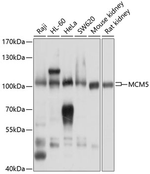 Western blot - MCM5 Polyclonal Antibody 