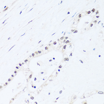 Immunohistochemistry - BRIX1 Polyclonal Antibody 