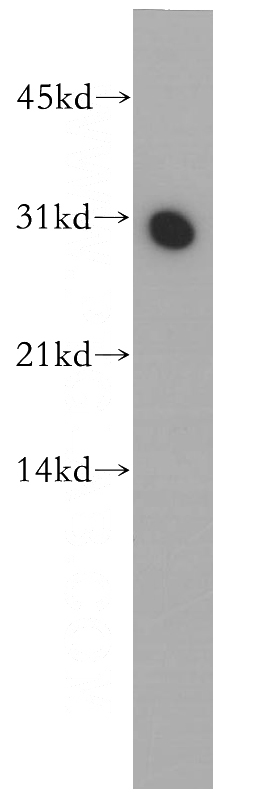 mouse skeletal muscle tissue were subjected to SDS PAGE followed by western blot with Catalog No:114734(RND3 antibody) at dilution of 1:400