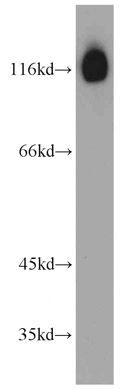 Jurkat cells were subjected to SDS PAGE followed by western blot with Catalog No:108390(BCL11B antibody) at dilution of 1:300