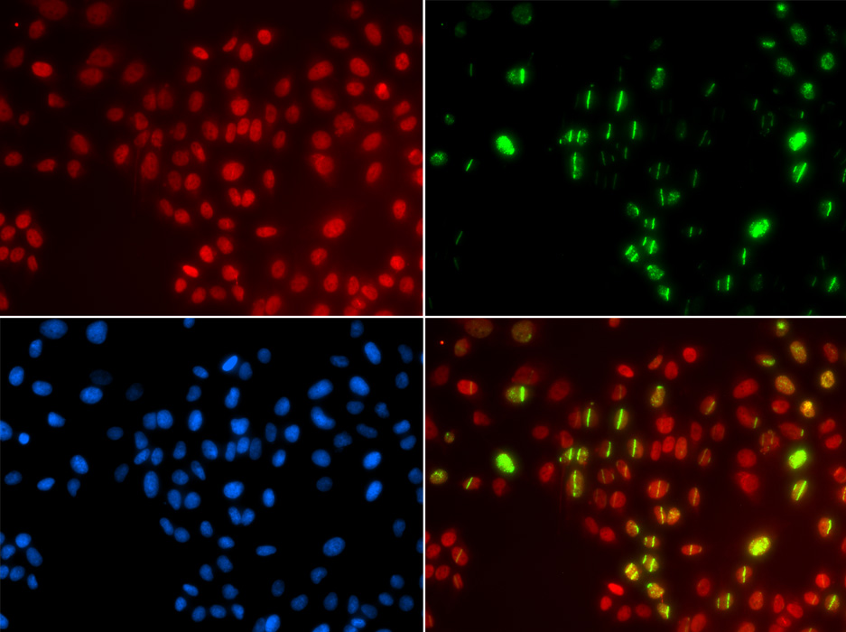 Immunofluorescence - DNA polymerase eta Polyclonal Antibody 