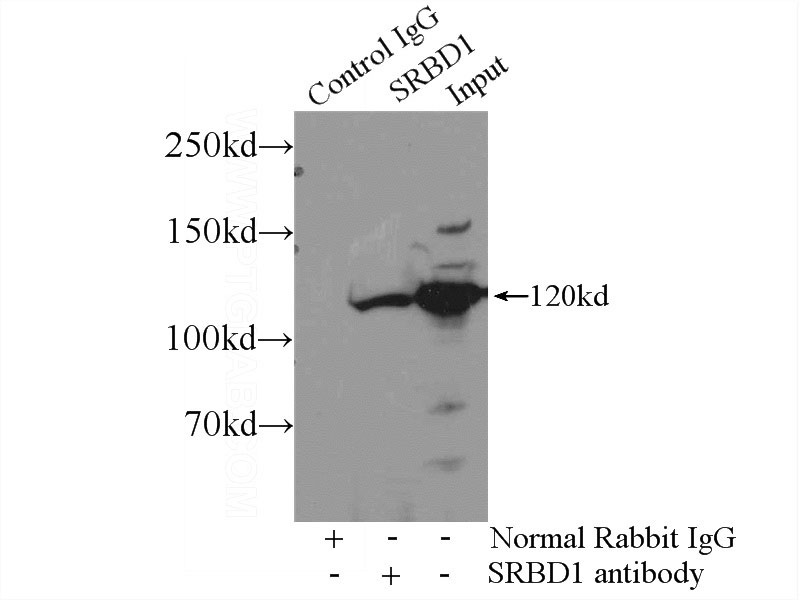 IP Result of anti-SRBD1 (IP:Catalog No:115663, 4ug; Detection:Catalog No:115663 1:300) with mouse brain tissue lysate 4000ug.