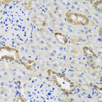 Immunohistochemistry - HK3 Polyclonal Antibody 