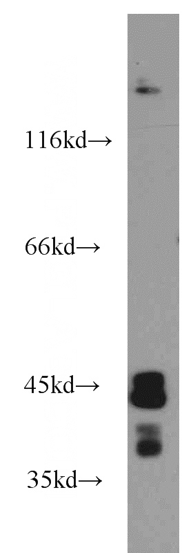 human brain tissue were subjected to SDS PAGE followed by western blot with Catalog No:115242(SIRT2 antibody) at dilution of 1:1000