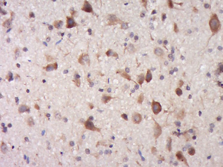 Fig1: Paraformaldehyde-fixed, paraffin embedded (Rat brain); Antigen retrieval by boiling in sodium citrate buffer (pH6.0) for 15min; Block endogenous peroxidase by 3% hydrogen peroxide for 20 minutes; Blocking buffer (normal goat serum) at 37℃ for 30min; Antibody incubation with (TRIM68) Polyclonal Antibody, Unconjugated at 1:400 overnight at 4℃, followed by operating according to SP Kit(Rabbit) (sp-0023) instructionsand DAB staining.