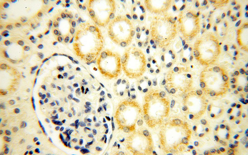 Immunohistochemical of paraffin-embedded human kidney using Catalog No:113636(PDRG1 antibody) at dilution of 1:100 (under 40x lens)