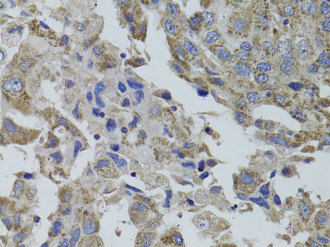 Immunohistochemistry - GNA15 Polyclonal Antibody 