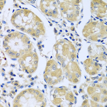 Immunohistochemistry - FBXL5 Polyclonal Antibody 