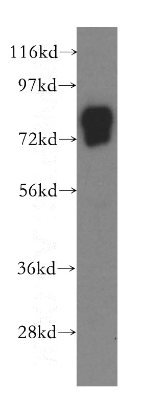 human serum tissue were subjected to SDS PAGE followed by western blot with Catalog No:116760(VTN antibody) at dilution of 1:1000