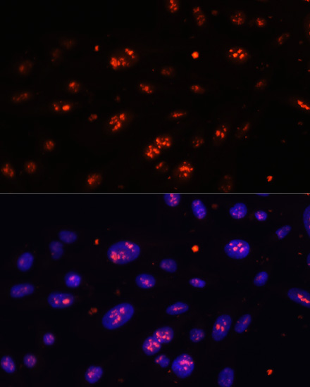 Immunofluorescence - DKC1 Polyclonal Antibody 