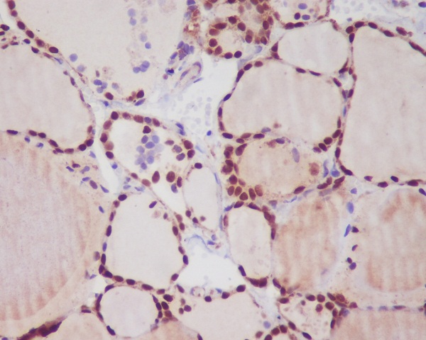 Immunohistochemical analysis of paraffin-embedded human thyroid, using TTF1 Antibody.