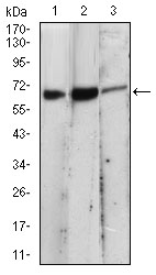 Western blot analysis using EIF2AK2 mouse mAb against A431 (1), MCF-7 (2), PC-12 (3) cell lysate.