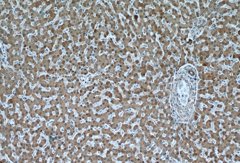 Immunohistochemical of paraffin-embedded human liver using Catalog No:111173(GSNOR,ADH5 antibody) at dilution of 1:50 (under 10x lens)