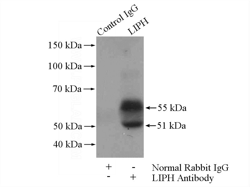 IP Result of anti-LIPH (IP:Catalog No:112243, 4ug; Detection:Catalog No:112243 1:500) with mouse lung tissue lysate 4000ug.