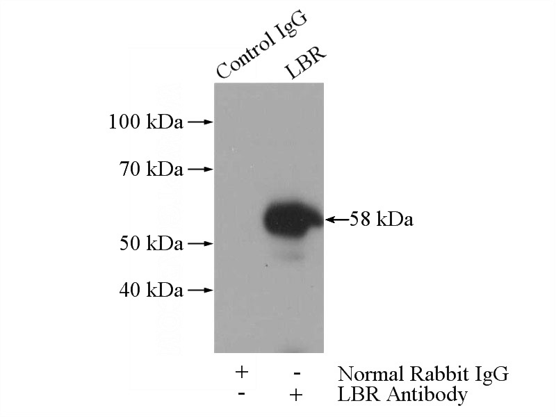 IP Result of anti-LBR (IP:Catalog No:112162, 3ug; Detection:Catalog No:112162 1:500) with A375 cells lysate 3200ug.