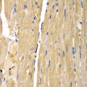 Immunohistochemistry - SLC25A13 Polyclonal Antibody 
