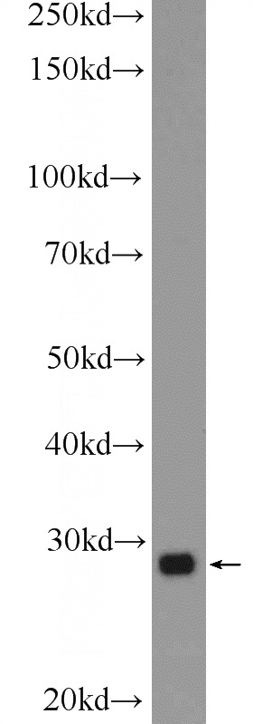 HeLa cells were subjected to SDS PAGE followed by western blot with Catalog No:110896(GBX2 Antibody) at dilution of 1:300