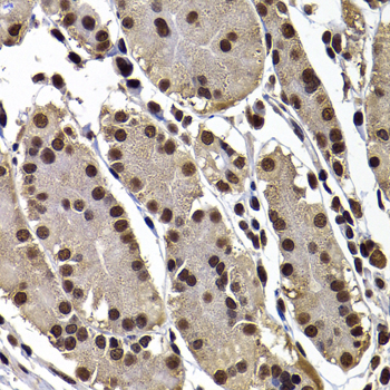 Immunohistochemistry - GPS1 Polyclonal Antibody 