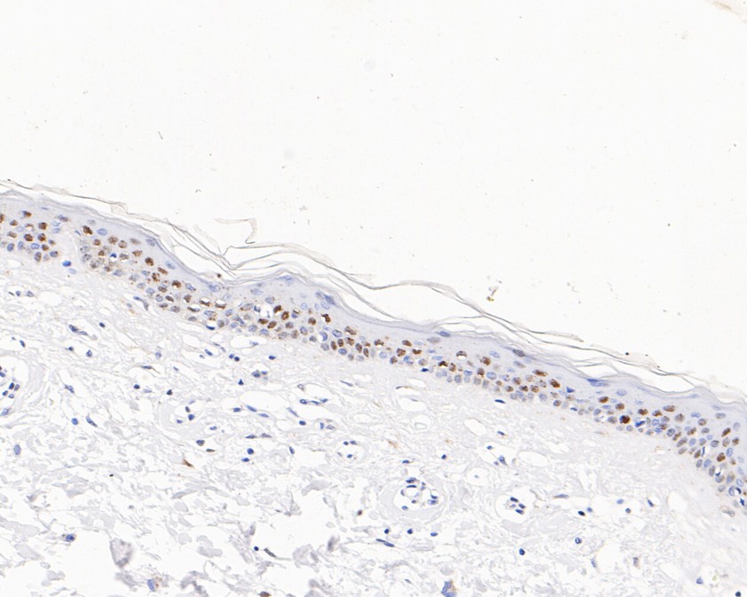 Fig6:; Immunohistochemical analysis of paraffin-embedded human skin tissue using anti-Phospho-Histone H1.3(T17)+Histone H1.4(T17) antibody. The section was pre-treated using heat mediated antigen retrieval with sodium citrate buffer (pH 6.0) for 20 minutes. The tissues were blocked in 5% BSA for 30 minutes at room temperature, washed with ddH; 2; O and PBS, and then probed with the primary antibody ( 1/200) for 30 minutes at room temperature. The detection was performed using an HRP conjugated compact polymer system. DAB was used as the chromogen. Tissues were counterstained with hematoxylin and mounted with DPX.