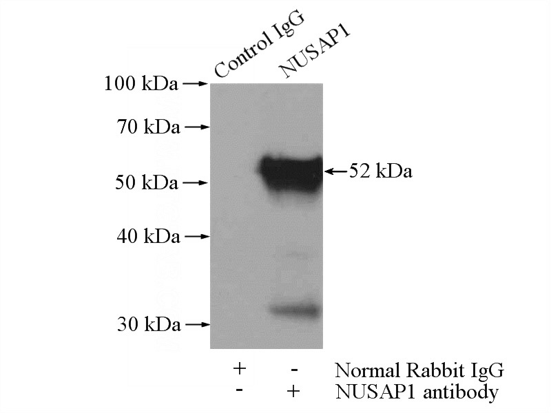 IP Result of anti-NUSAP1 (IP:Catalog No:113448, 4ug; Detection:Catalog No:113448 1:500) with HeLa cells lysate 2000ug.