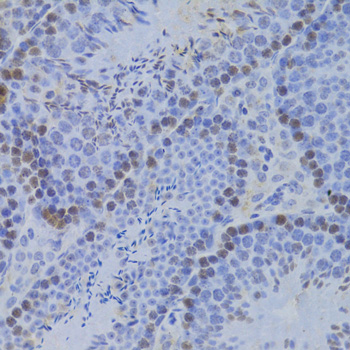 Immunohistochemistry - JMJD6 Polyclonal Antibody 
