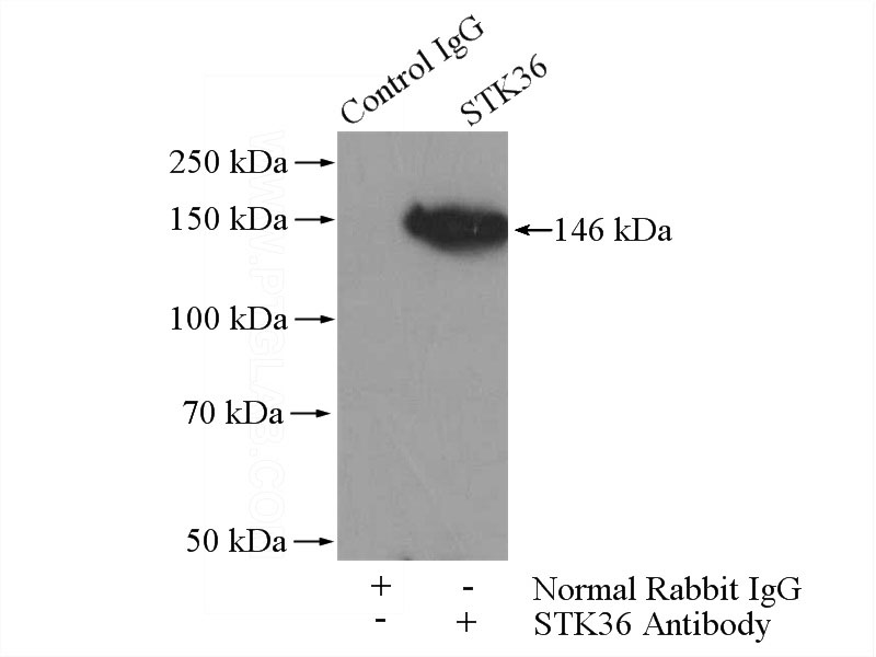 IP Result of anti-STK36 (IP:Catalog No:115721, 4ug; Detection:Catalog No:115721 1:500) with mouse testis tissue lysate 4000ug.